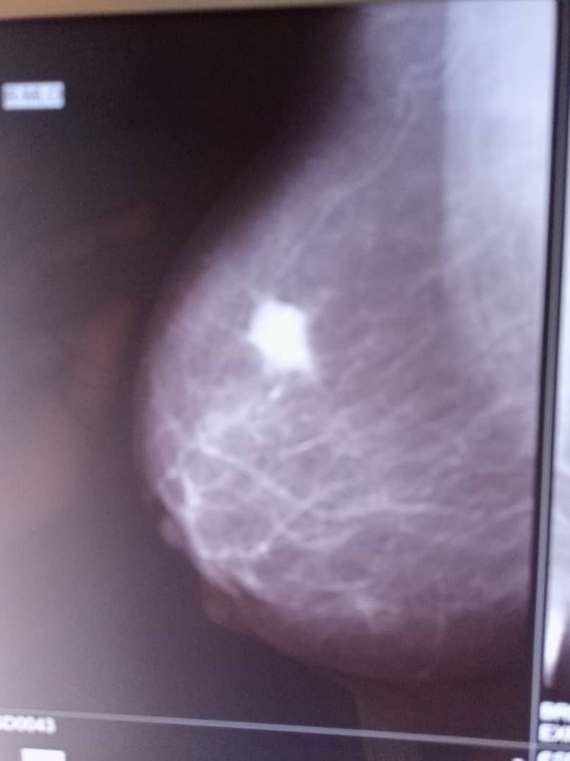 WhatsApp Image 2025-04-14 at 8.39.25 AM